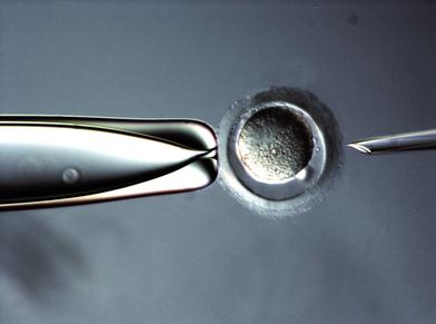徠卡顯微鏡什么是綜合調節對比(IMC)?