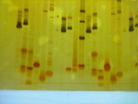 丙烯酰胺電泳圖片分析,條帶有問題 丙烯酰胺電泳圖片分析,條帶有問題